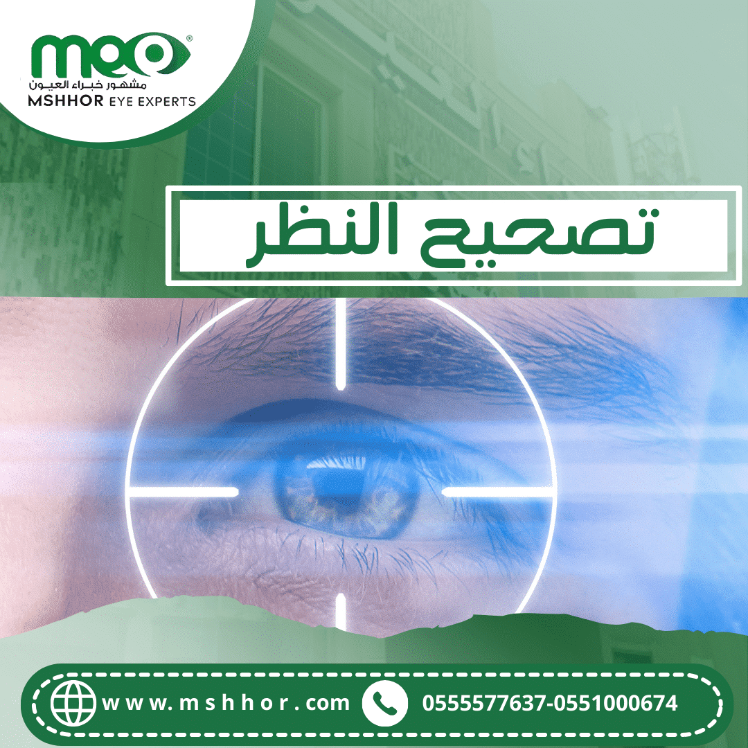 تصحيح النظر