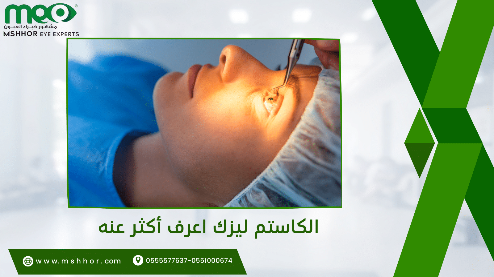 الكاستم ليزك اعرف أكثر عنه