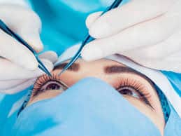اسباب عملية الليزر للعين