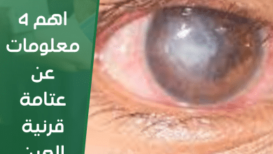اهم 4 معلومات عن عتامة قرنية العين