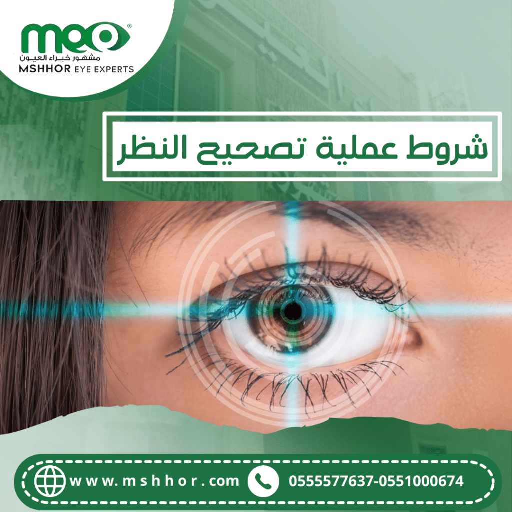  شروط عملية تصحيح النظر