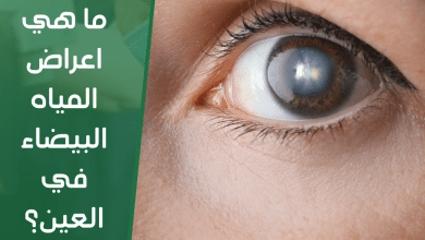 ما هي اعراض المياه البيضاء في العين ؟