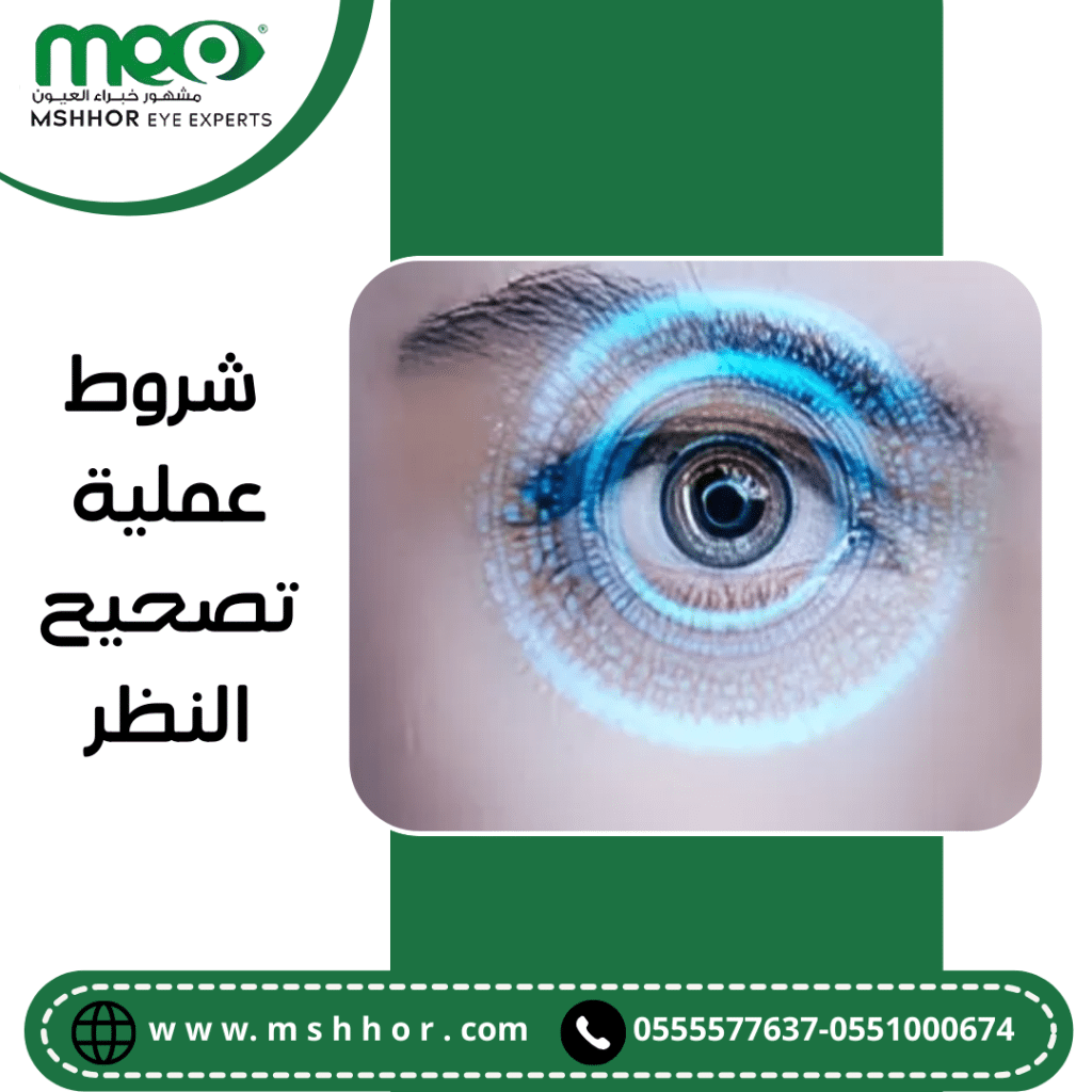  شروط عملية تصحيح النظر