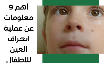 أهم 9 معلومات عن عملية انحراف العين للاطفال