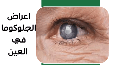 اعراض الجلوكوما في العين