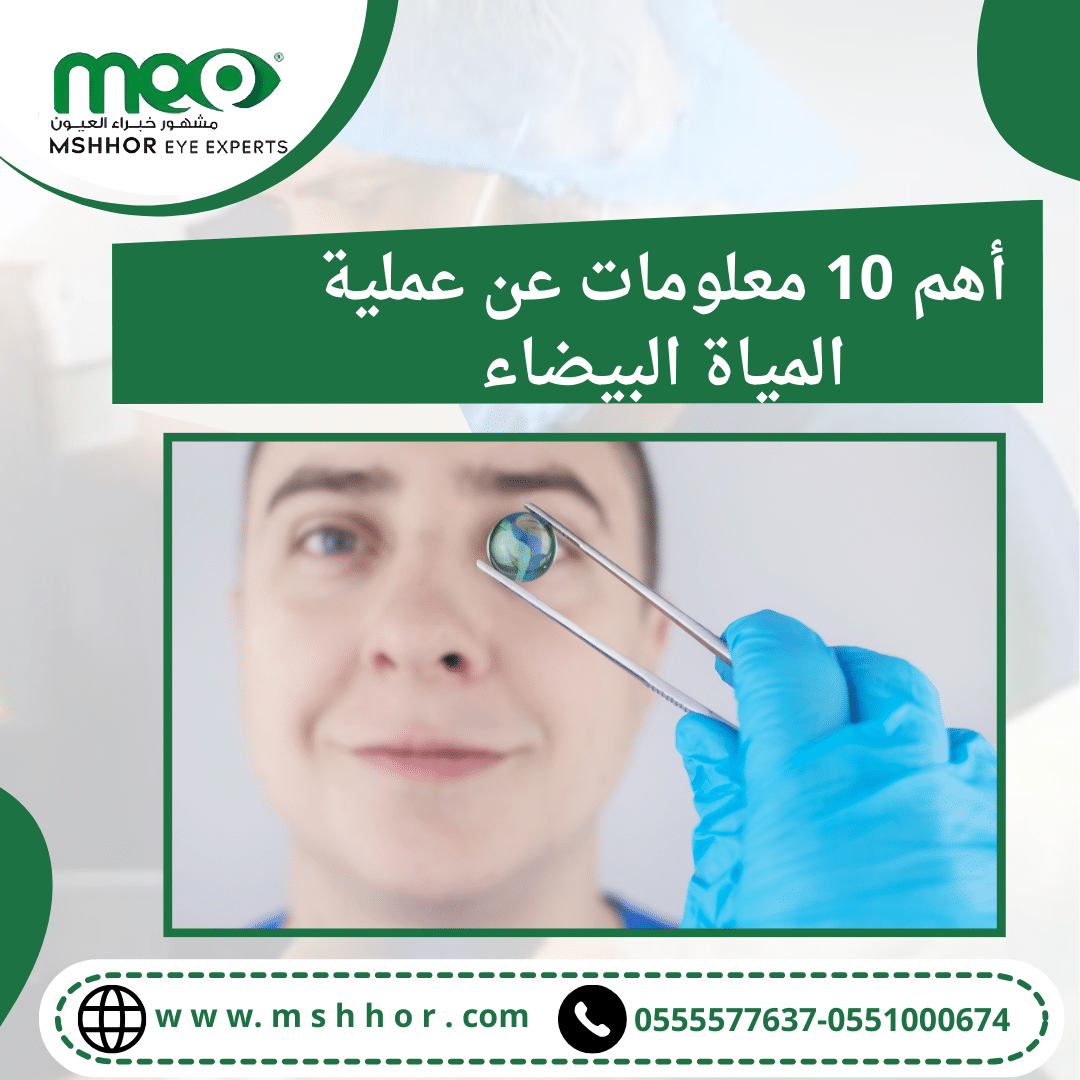 أهم 10 معلومات عن عملية المياة البيضاء