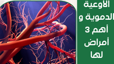 الأوعية الدموية و أهم 3 أمراض لها