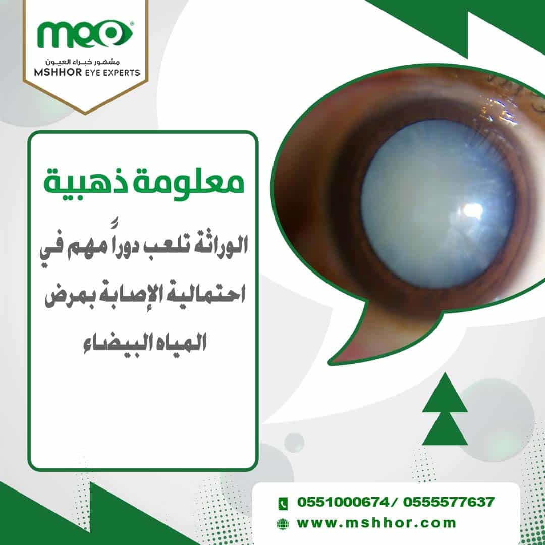 علاج احمرار العين بعد عملية المياه البيضاء