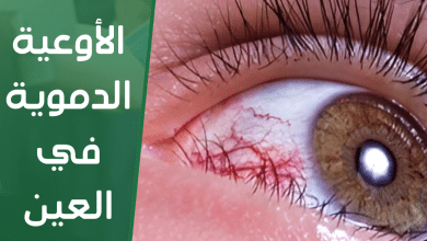 الأوعية الدموية في العين