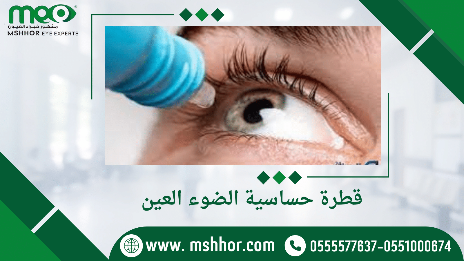 قطرة حساسية الضوء العين