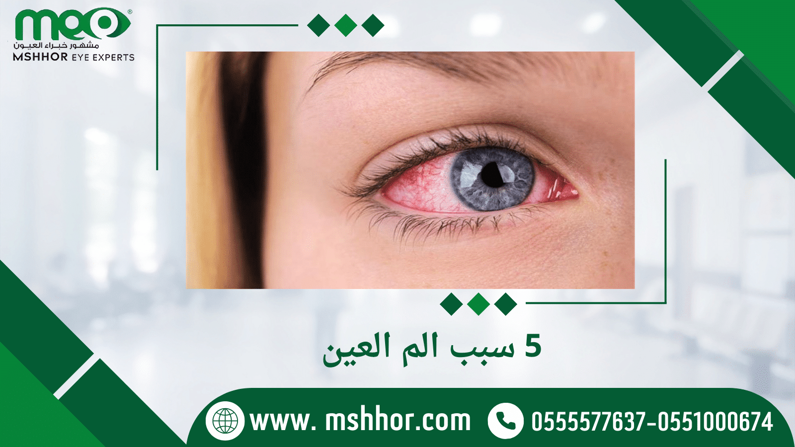 5 سبب الم العين