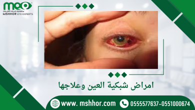 امراض شبكية العين وعلاجها