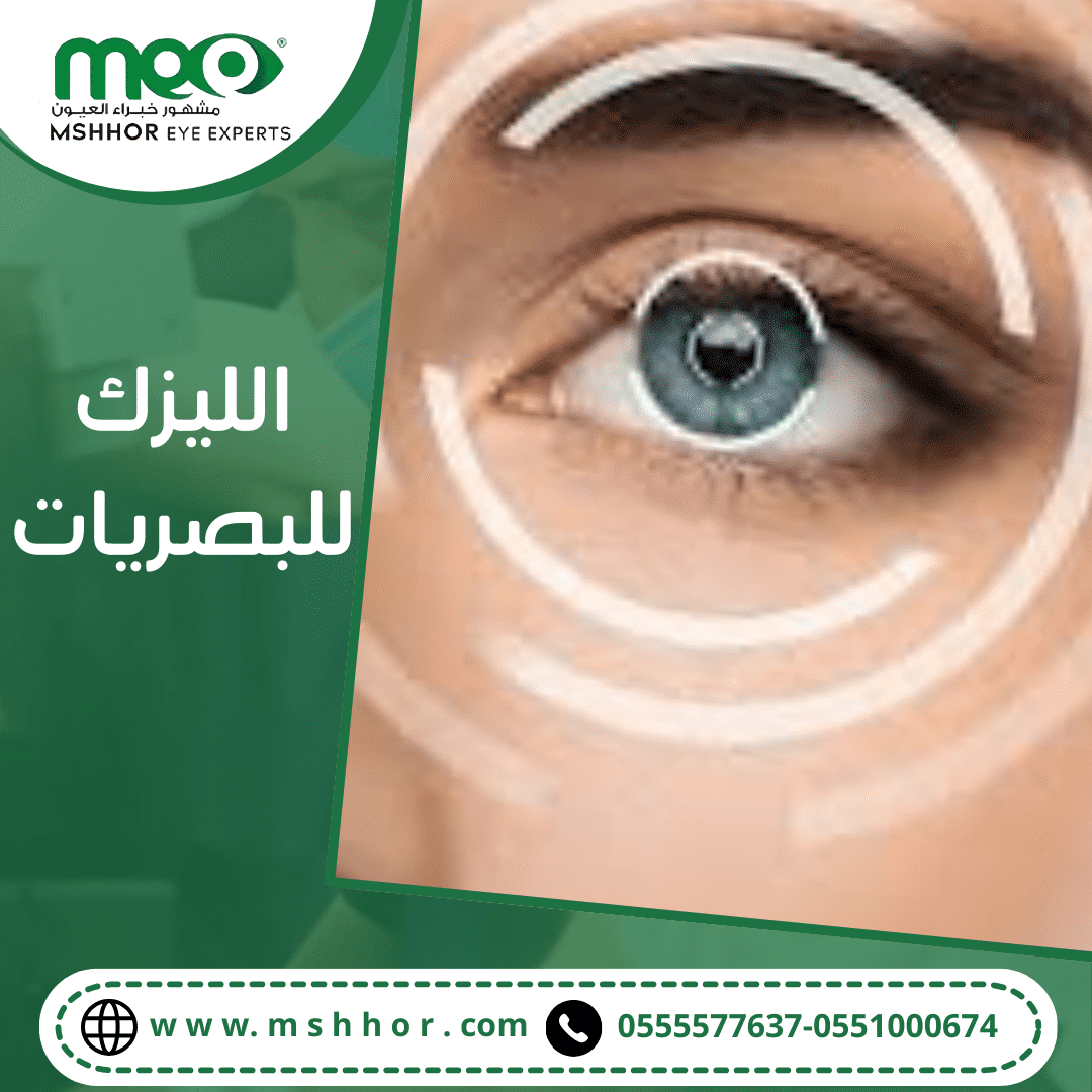 الليزك للبصريات