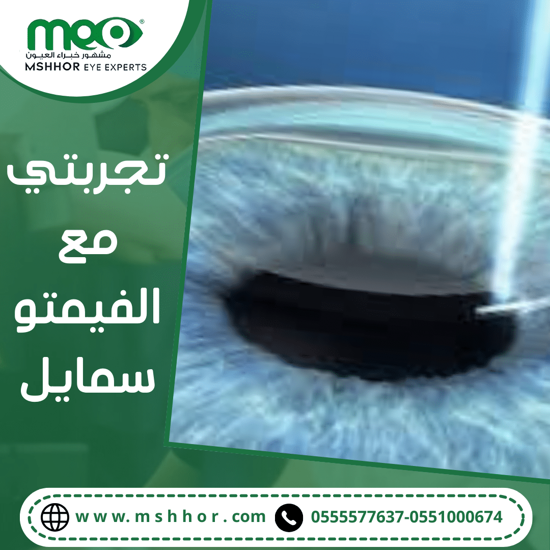 تجربتي مع الفيمتو سمايل