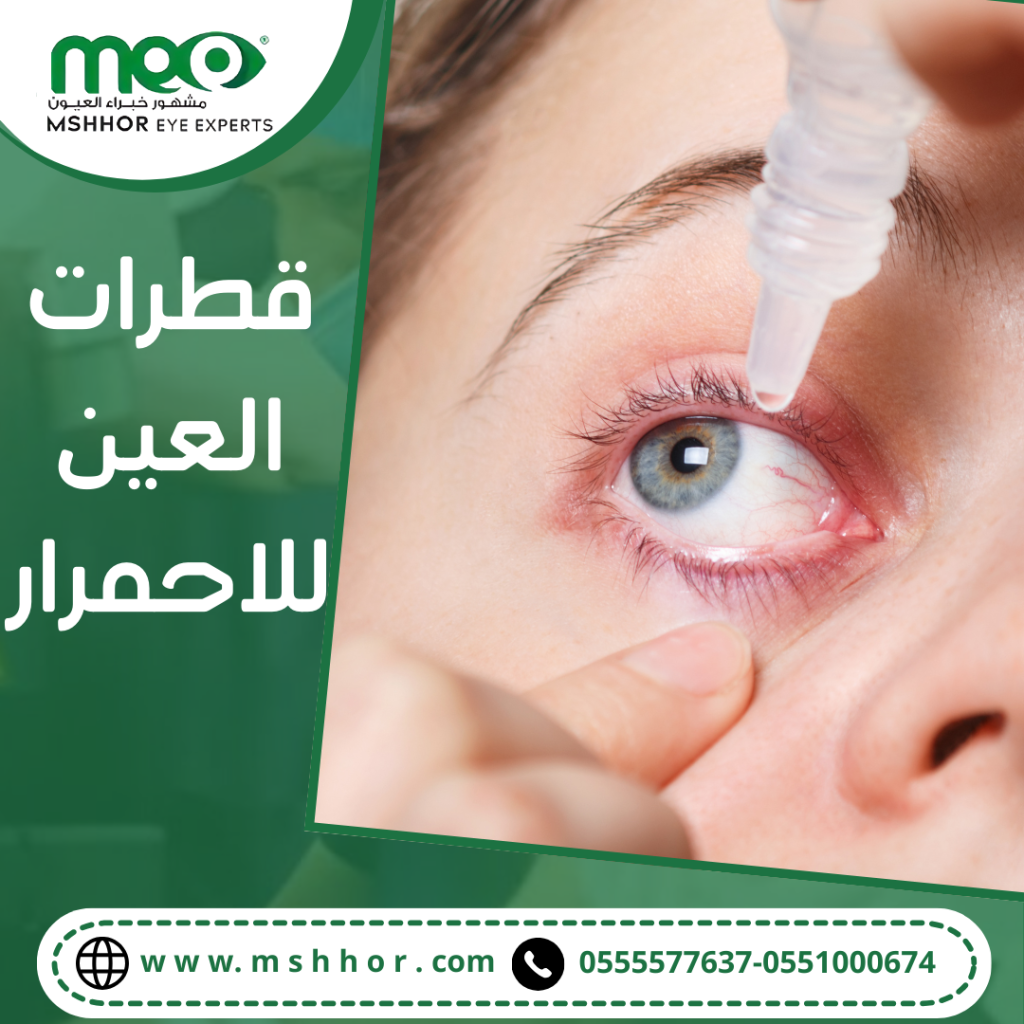 قطرات العين للاحمرار