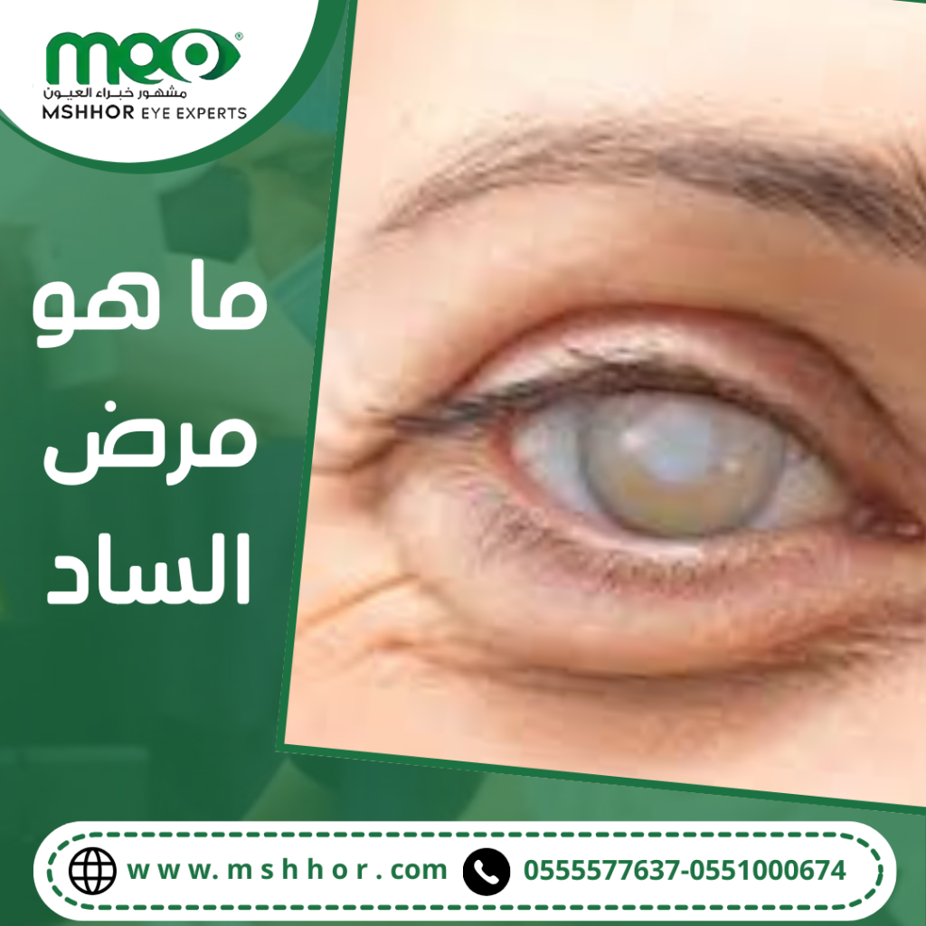 ما هو مرض الساد
