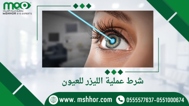 شرط عملية الليزر للعيون