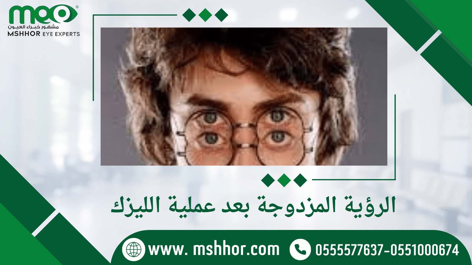 الرؤية المزدوجة بعد عملية الليزك