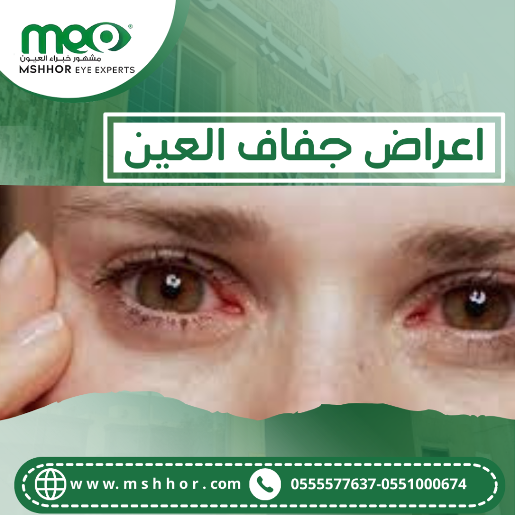 اعراض جفاف العين