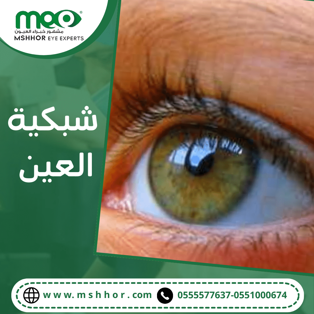 شبكية العين