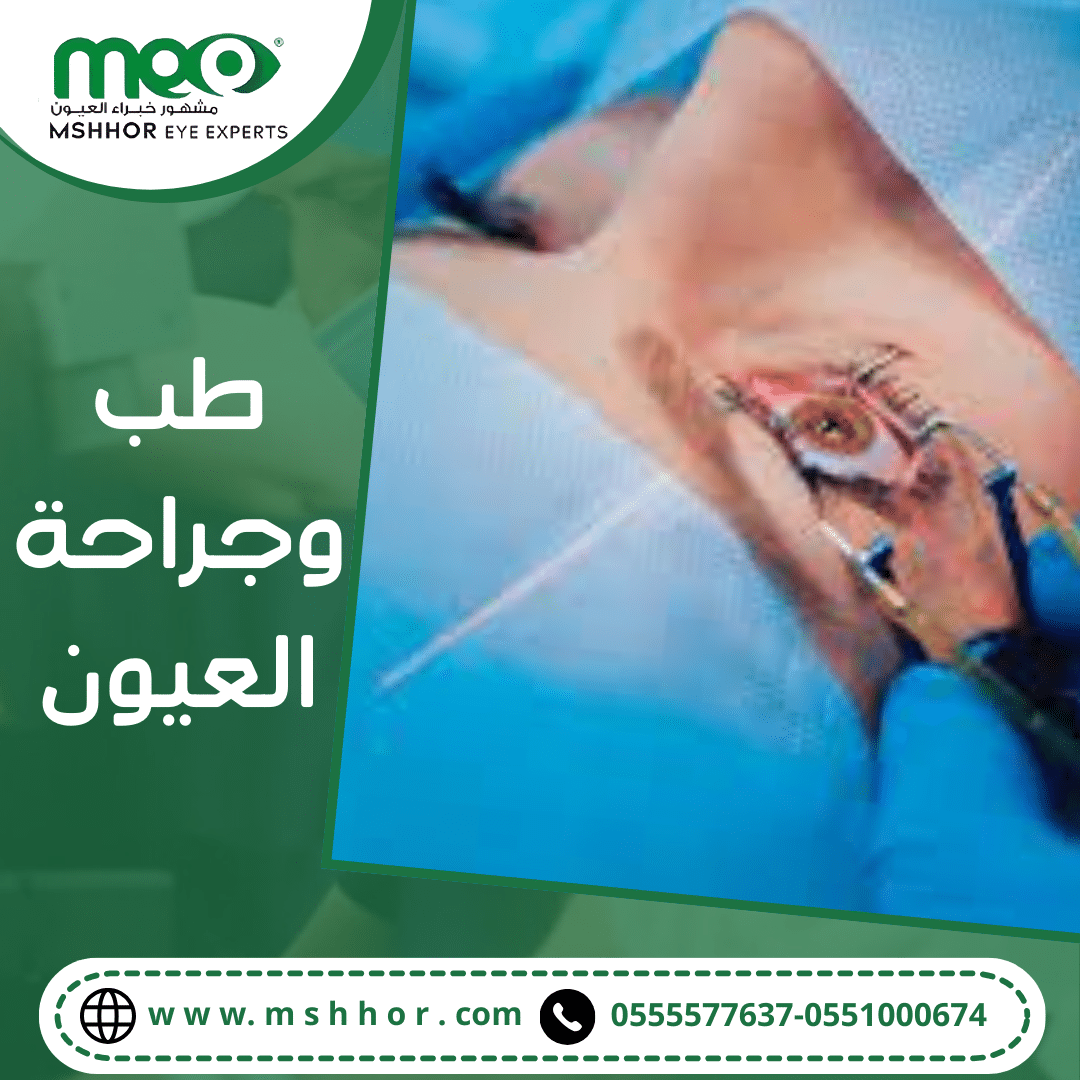 طب وجراحة العيون