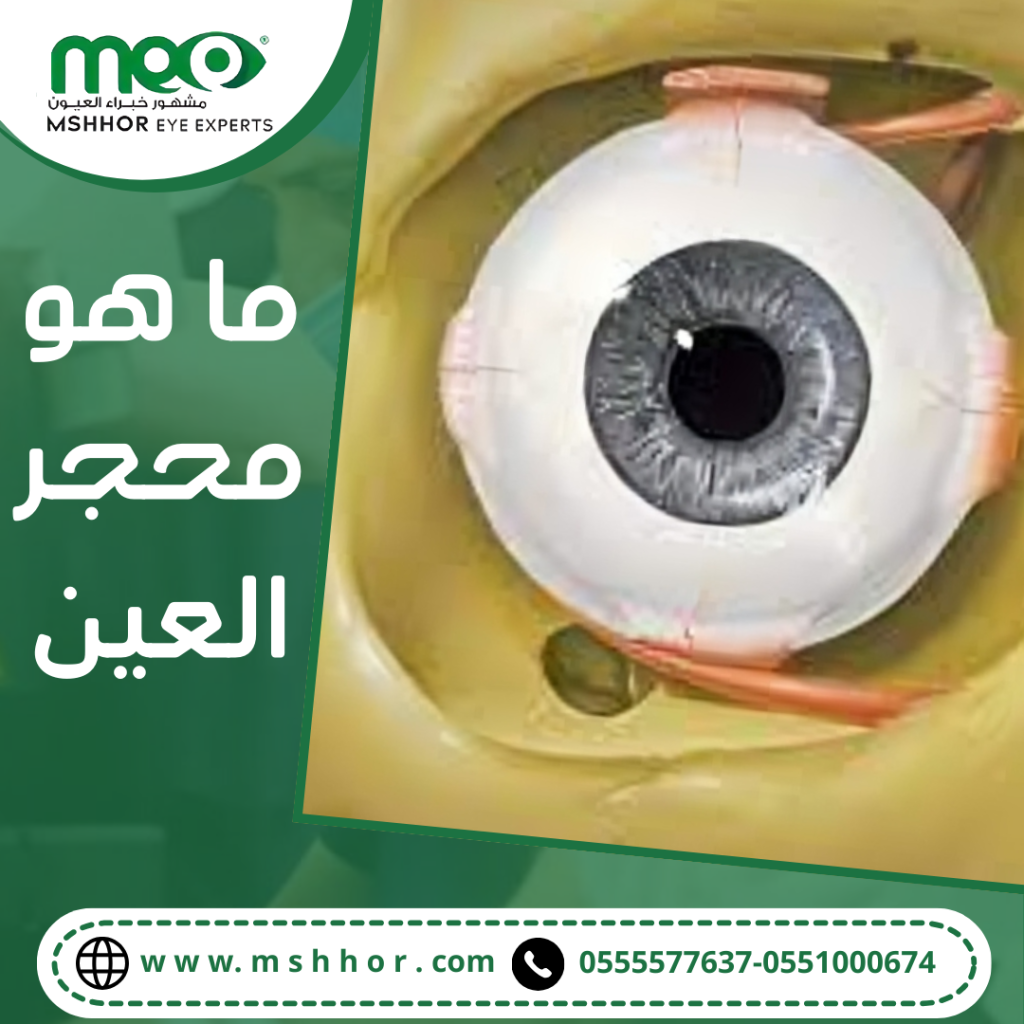 محجر العين