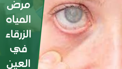 مرض المياه الزرقاء في العين
