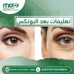 تعليمات بعد البوتكس