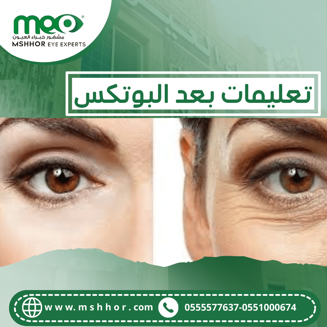 تعليمات بعد البوتكس