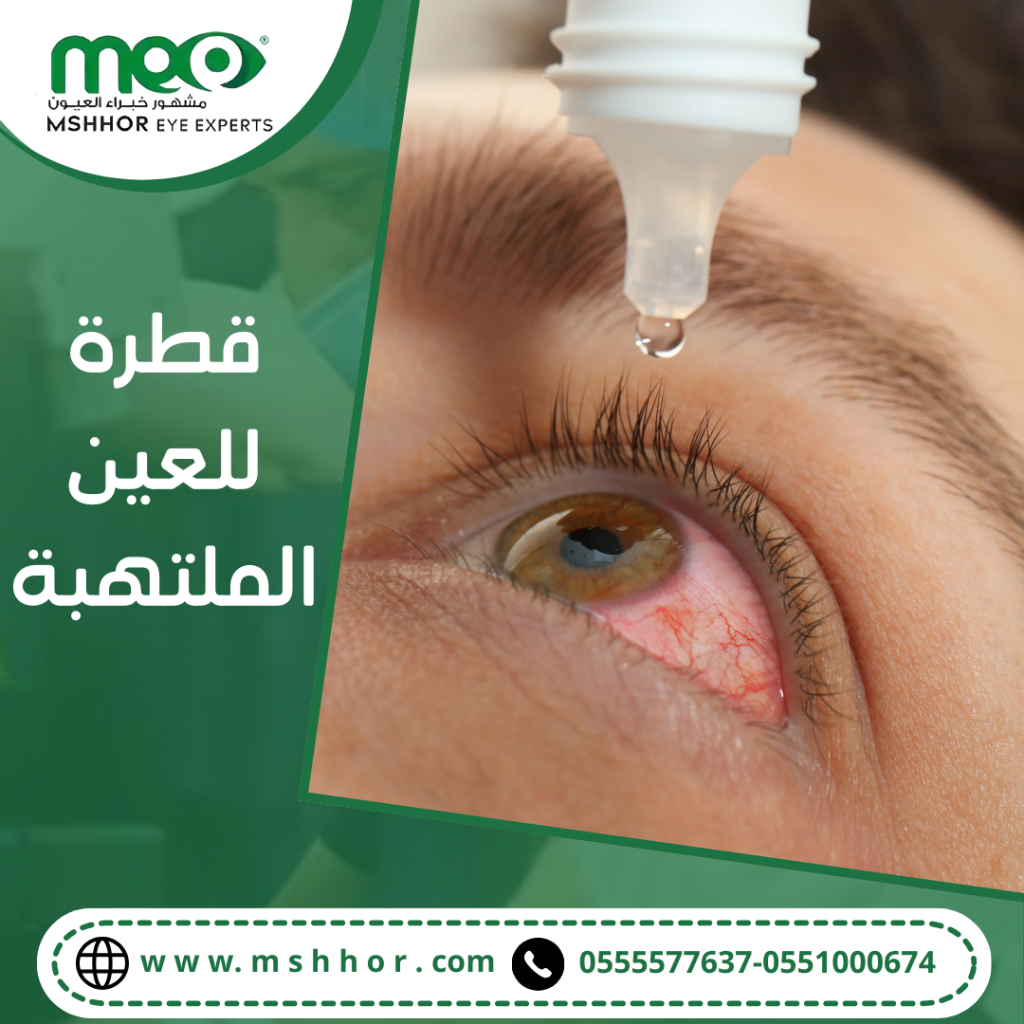 قطرة للعين الملتهبة