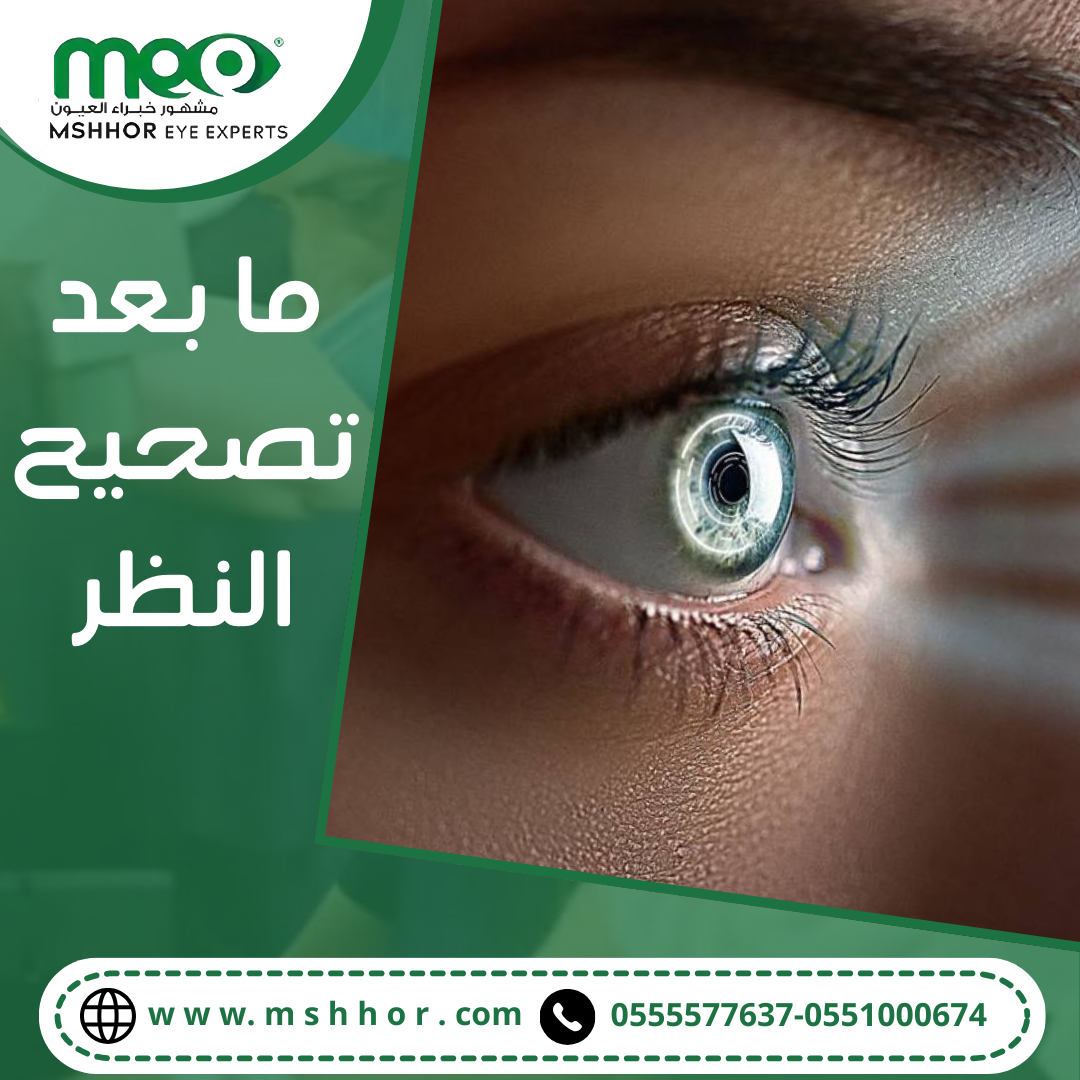ما بعد تصحيح النظر