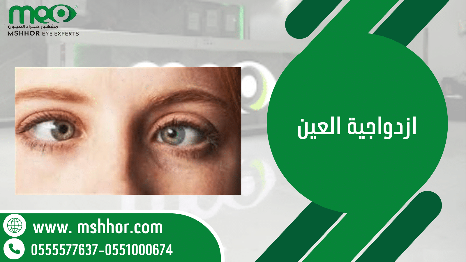 ازدواجية العين