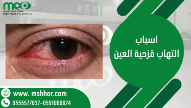 اسباب التهاب قزحية العين