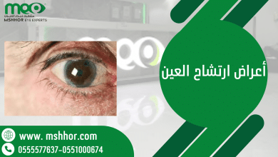 أعراض ارتشاح العين