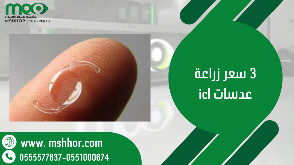 3 سعر زراعة عدسات icl