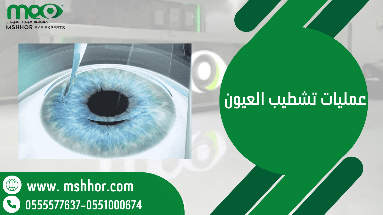 عمليات تشطيب العيون