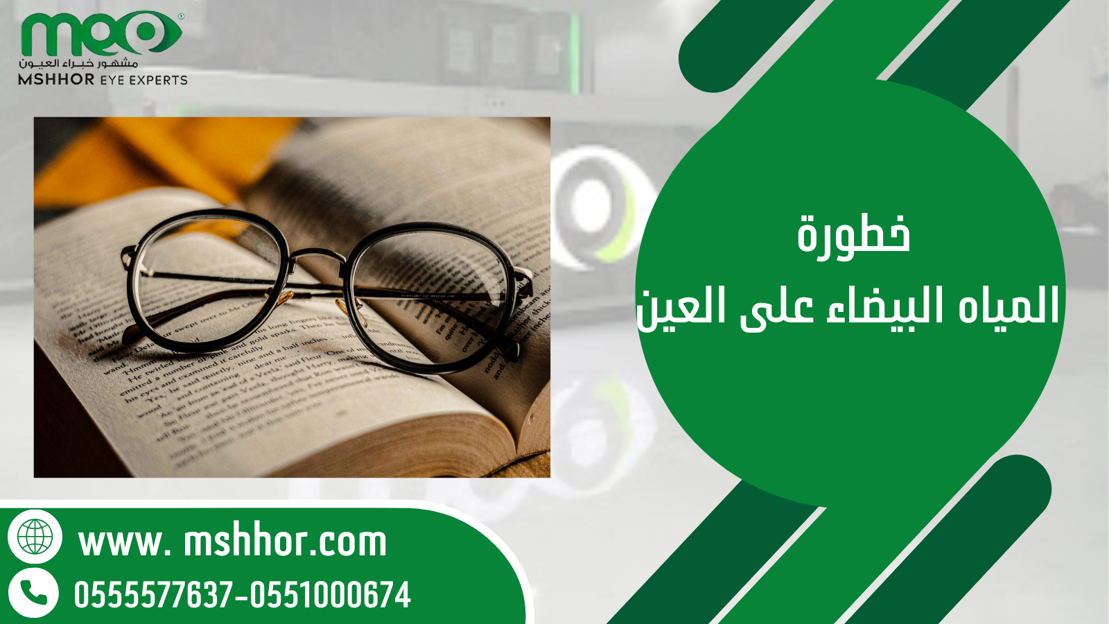 خطورة المياه البيضاء على العين