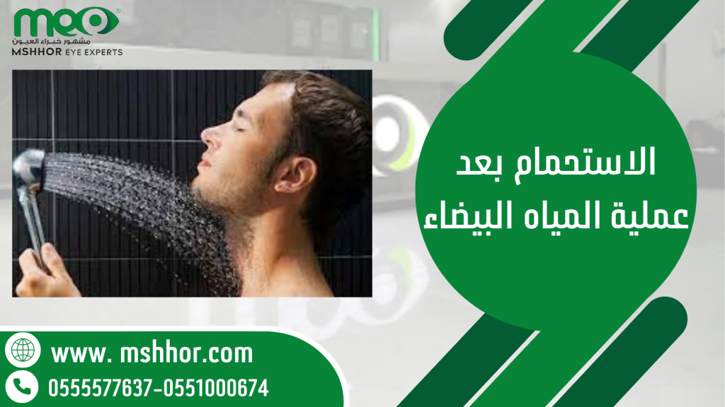 الاستحمام بعد عملية المياه البيضاء