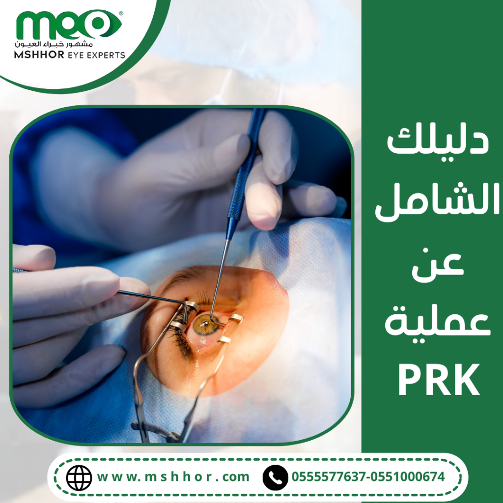 عملية PRK