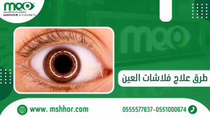 هل تختفي فلاشات العين