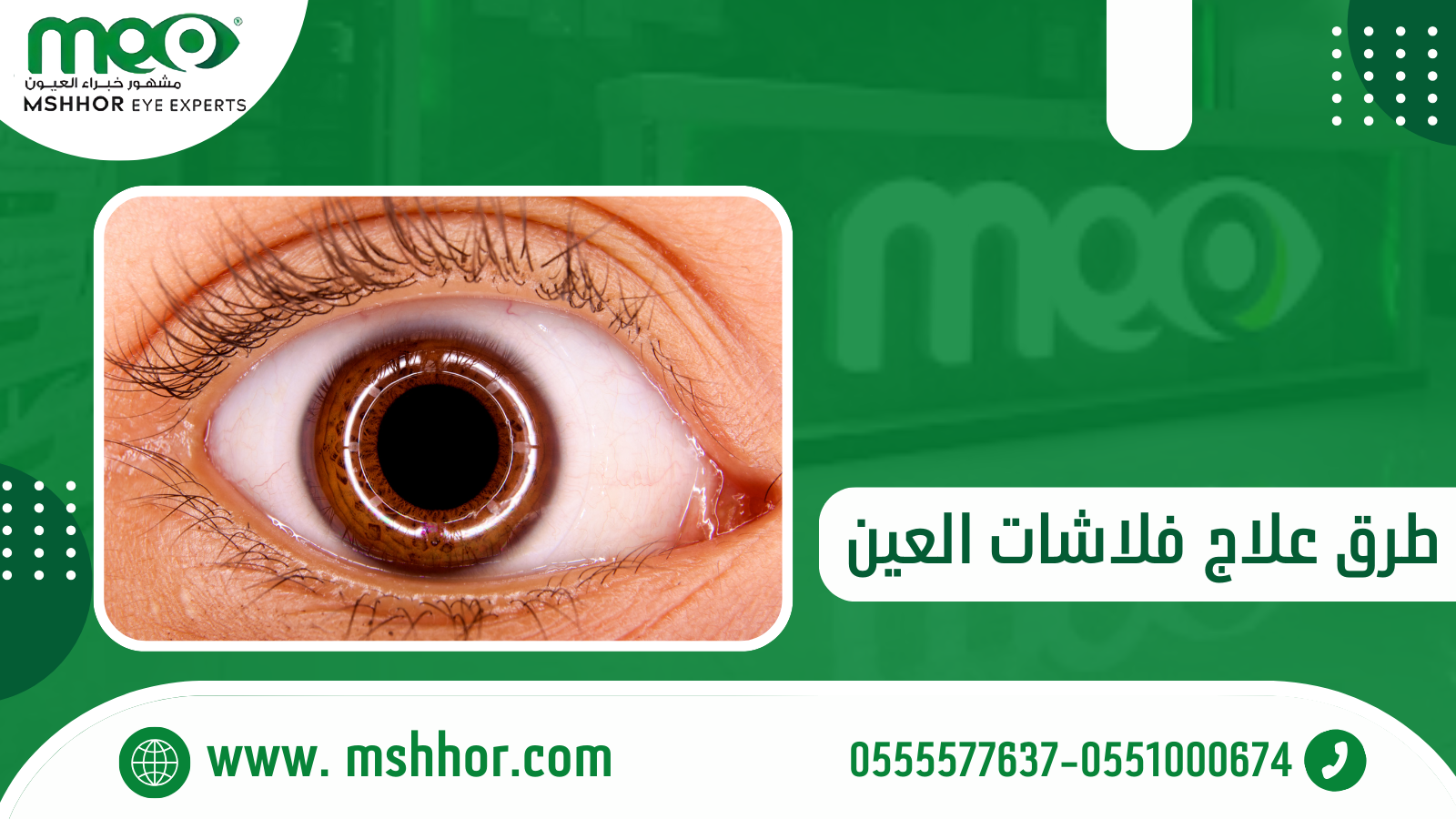 هل تختفي فلاشات العين