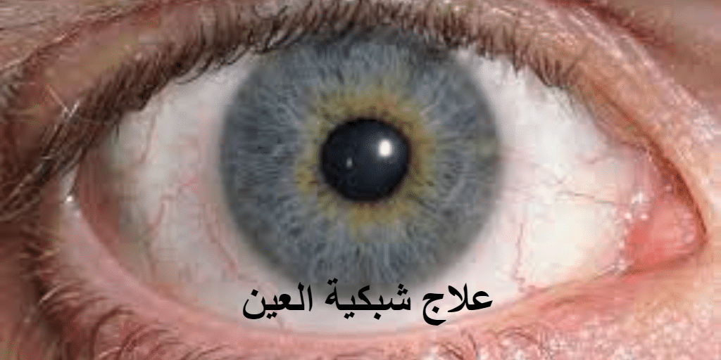 علاج شبكية العين