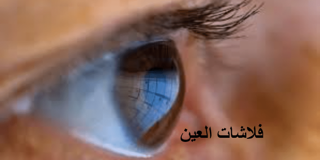 فلاشات العين