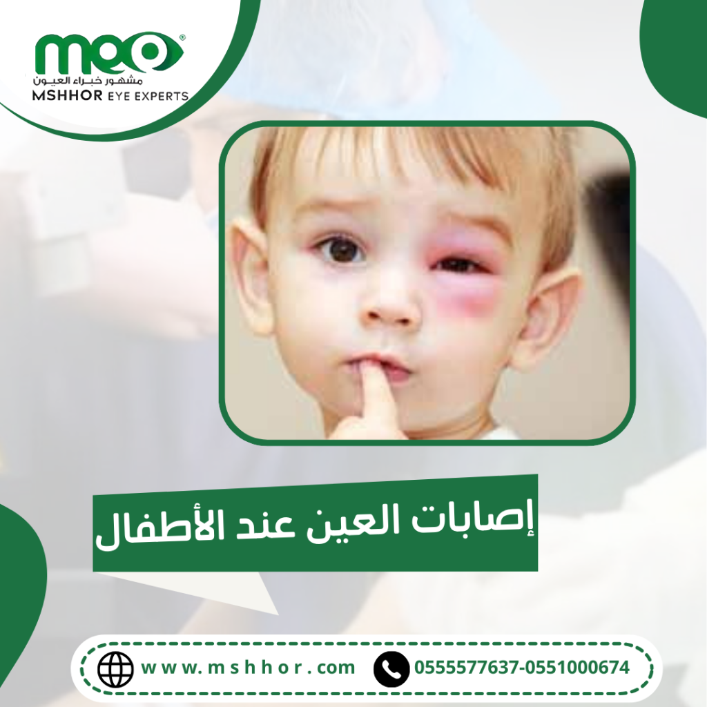 أنواع إصابات العين عند الأطفال