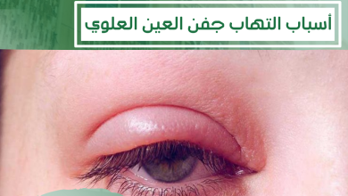 التهاب جفن العين العلوي