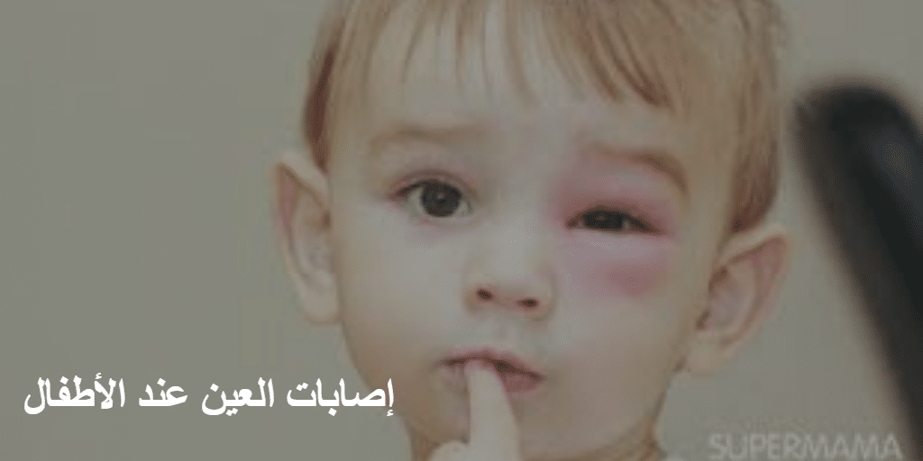 إصابات العين عند الأطفال