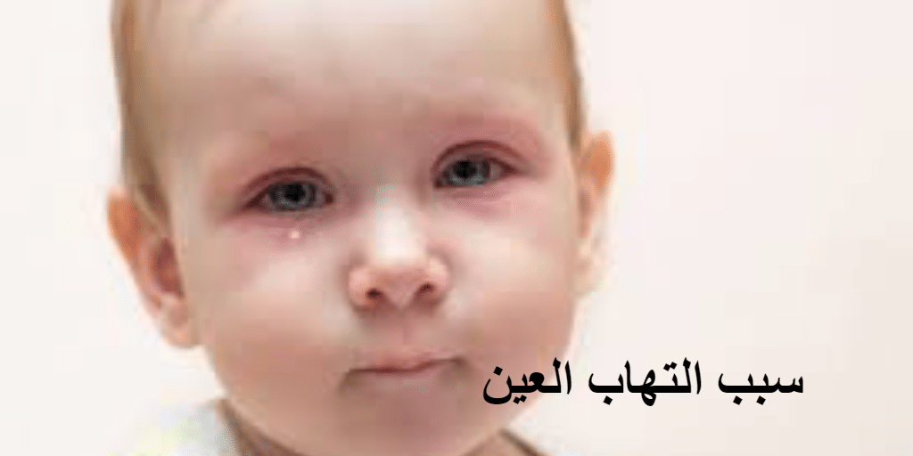 سبب التهاب العين