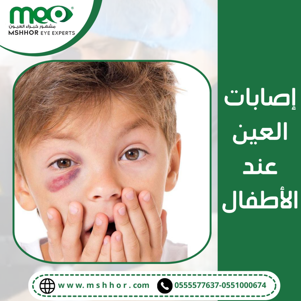 أعراض إصابات العين عند الأطفال