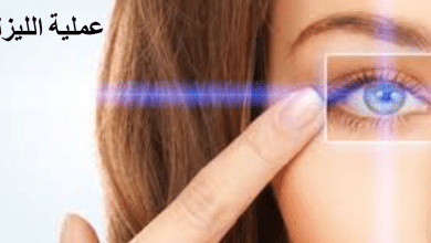 ليزك العيون - جراحة العين بتقنية الليزك 2023