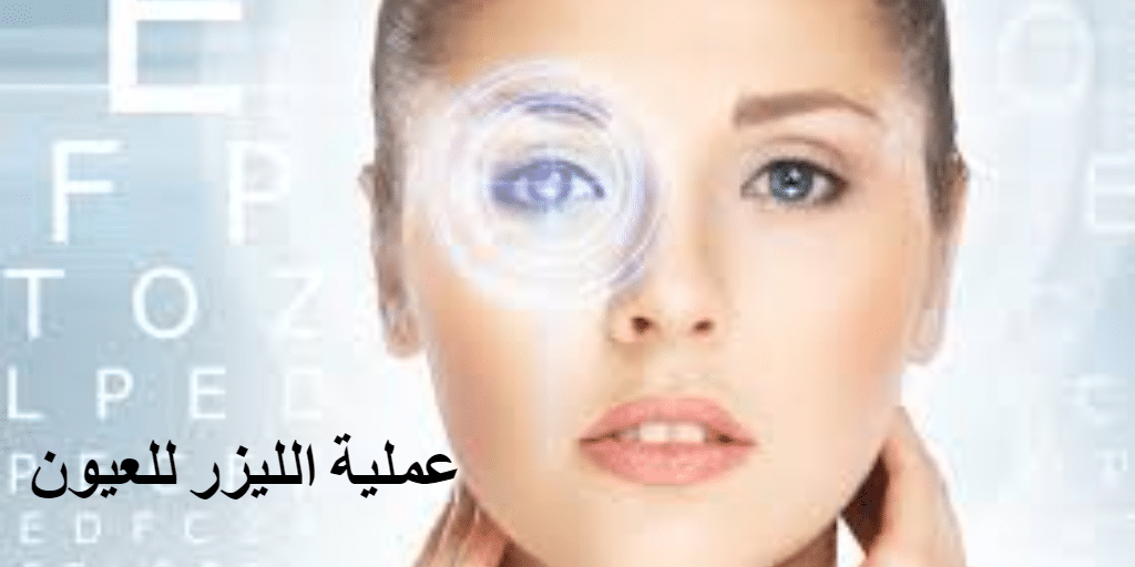 تقدير واقعي للتوقعات (شروط عملية الليزر للعيون)